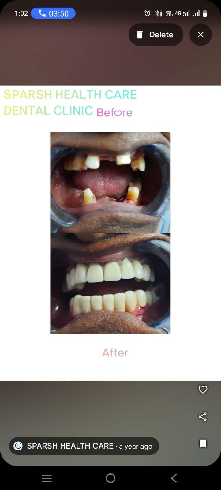 Complete Dental Restoration
