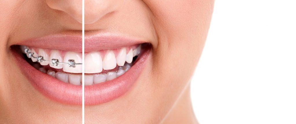 Cosmetic Dentistry